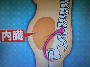 ポッコリお腹の原因 画像