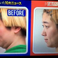 【林先生が驚く初耳学】二重あごを解消するストレッチ&バスタオル枕